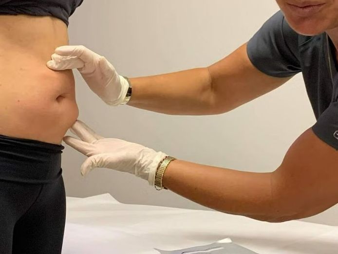 the-body-clinic-nq-townsville-2