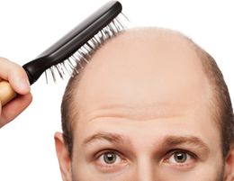 Highly Successful Hair Loss Treatment Business for Sale / Gold Coast