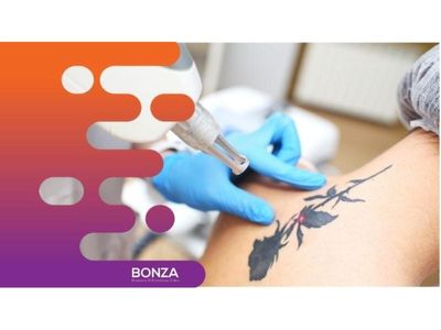35568-laser-tattoo-removal-clinic-fully-equipped-1