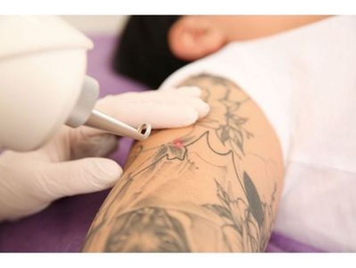 tattoo-removal-skin-rejuvenation-and-scalp-micropigmentation-0