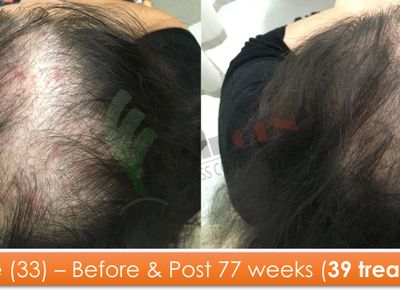 exciting-business-opportunity-in-the-hair-loss-treatment-industry-sydney-nsw-3
