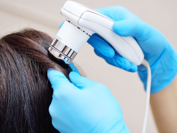 exciting-business-opportunity-in-the-hair-loss-treatment-industry-sydney-nsw-0