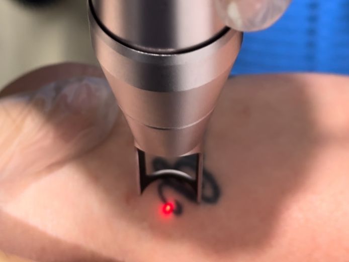 cosmetic-injectables-and-advanced-aesthetics-clinic-taree-nsw-8