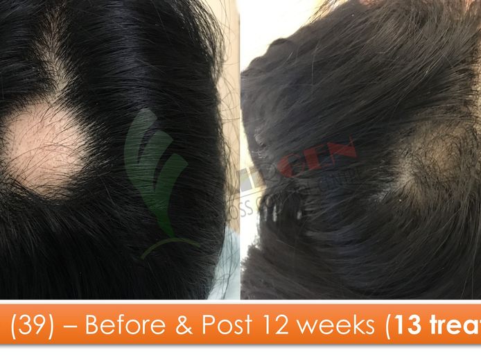 exciting-business-opportunity-in-the-hair-loss-treatment-industry-sydney-nsw-7