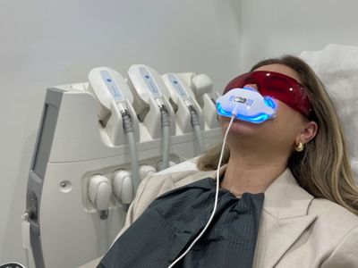 for-sale-mobile-cosmetic-teeth-whitening-business-reputatble-side-business-3