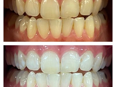 reputable-luxury-beauty-cosmetic-teeth-whitening-clinic-subiaco-wa-6