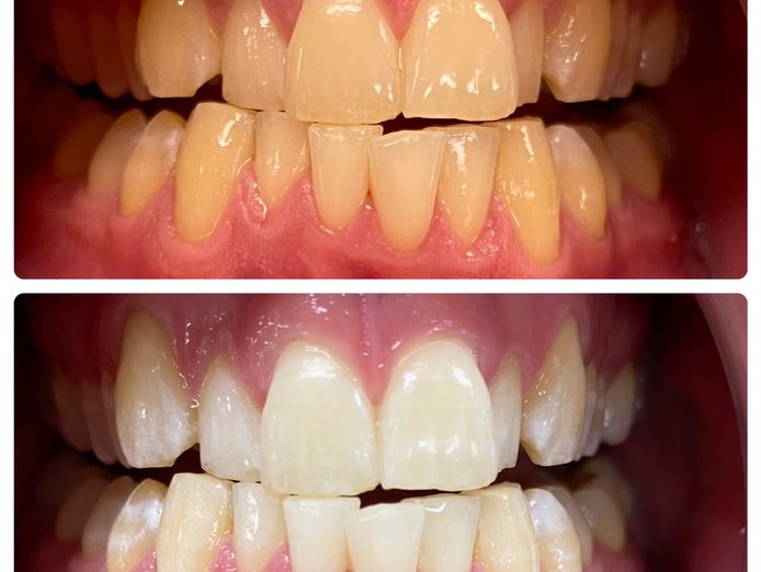 reputable-luxury-beauty-cosmetic-teeth-whitening-clinic-subiaco-wa-7