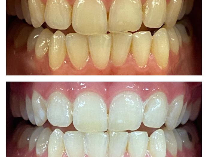 reputable-luxury-beauty-cosmetic-teeth-whitening-clinic-subiaco-wa-6