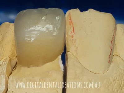 crown-and-bridge-dental-laboratory-for-sale-6