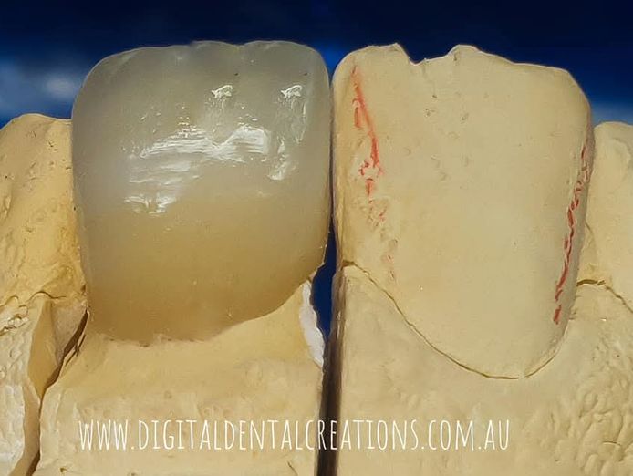crown-and-bridge-dental-laboratory-for-sale-6