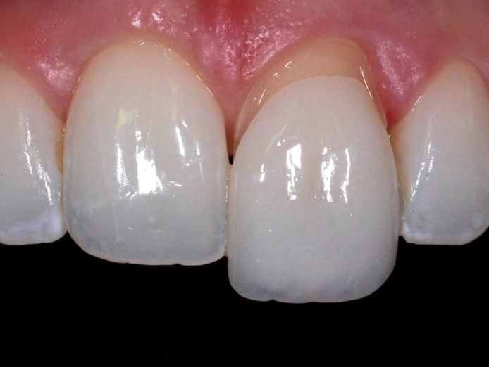 crown-and-bridge-dental-laboratory-for-sale-0